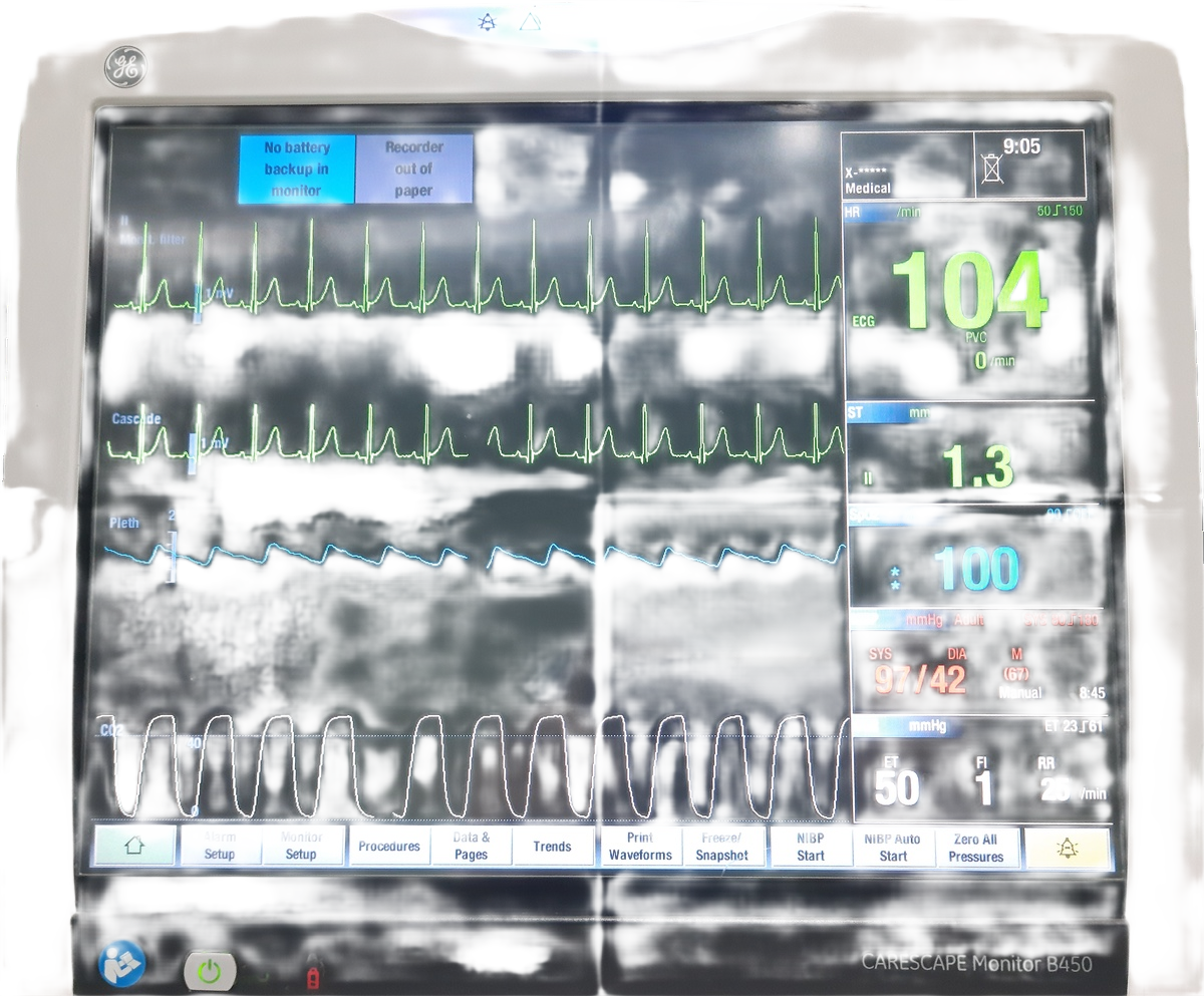 Patient monitor