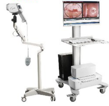 Colposcope (SWM 11085)