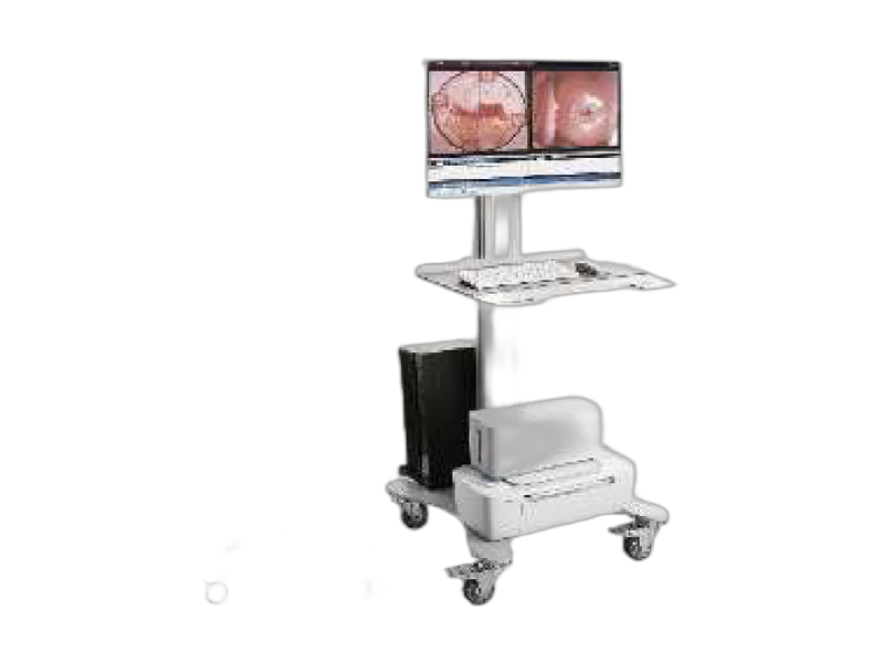 Digital Video Colposcope Workstation