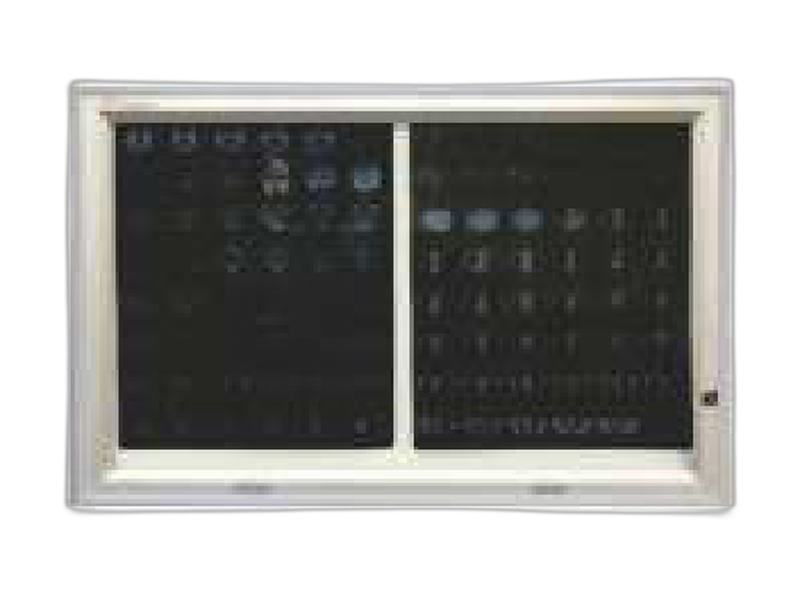 Flush Mounted LED X-Ray Viewer
